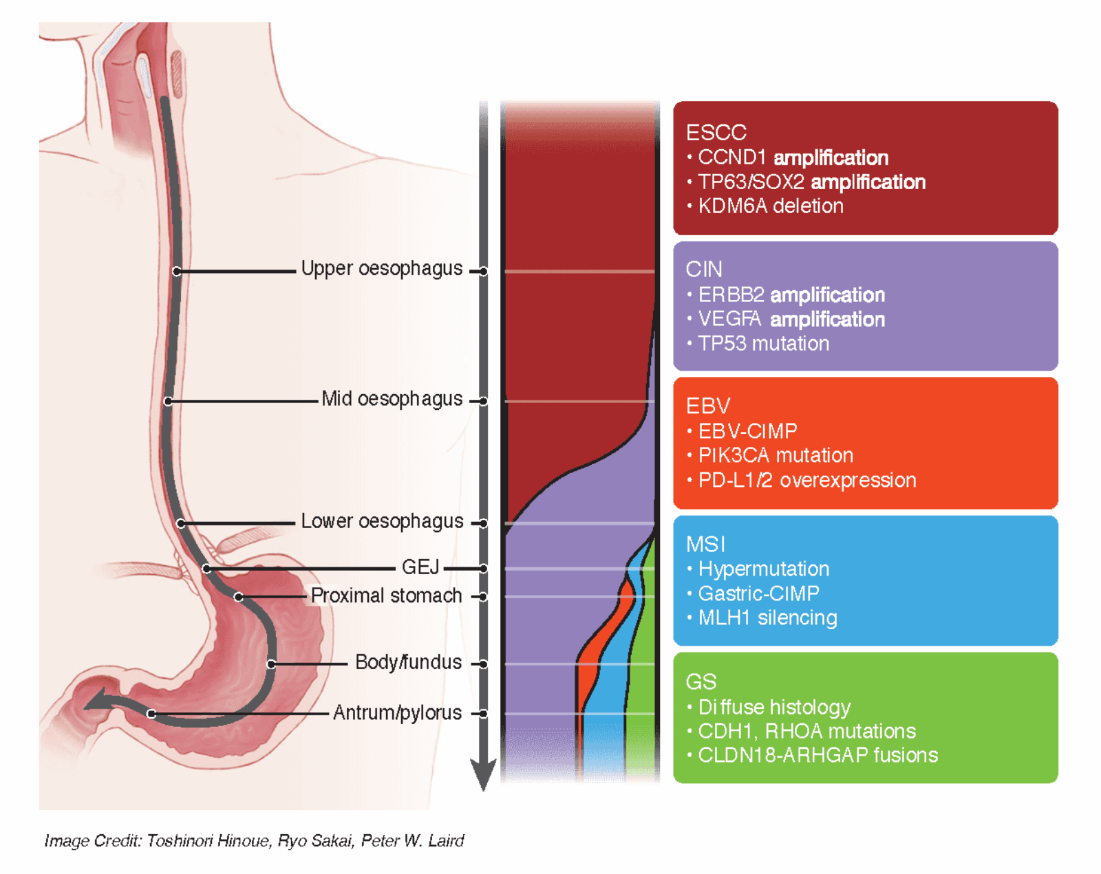 Comprehensive study of esophageal cancer reveals several molecular ...