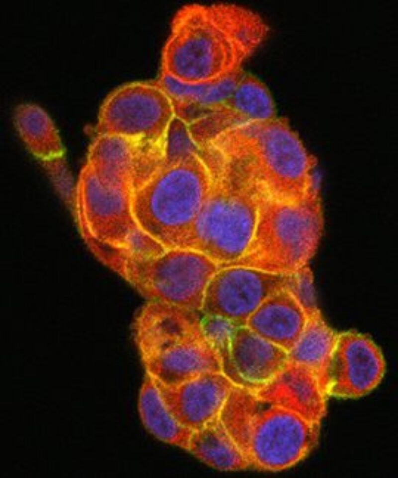 Breast Cancer Awareness Month: A look at the latest research – Van ...