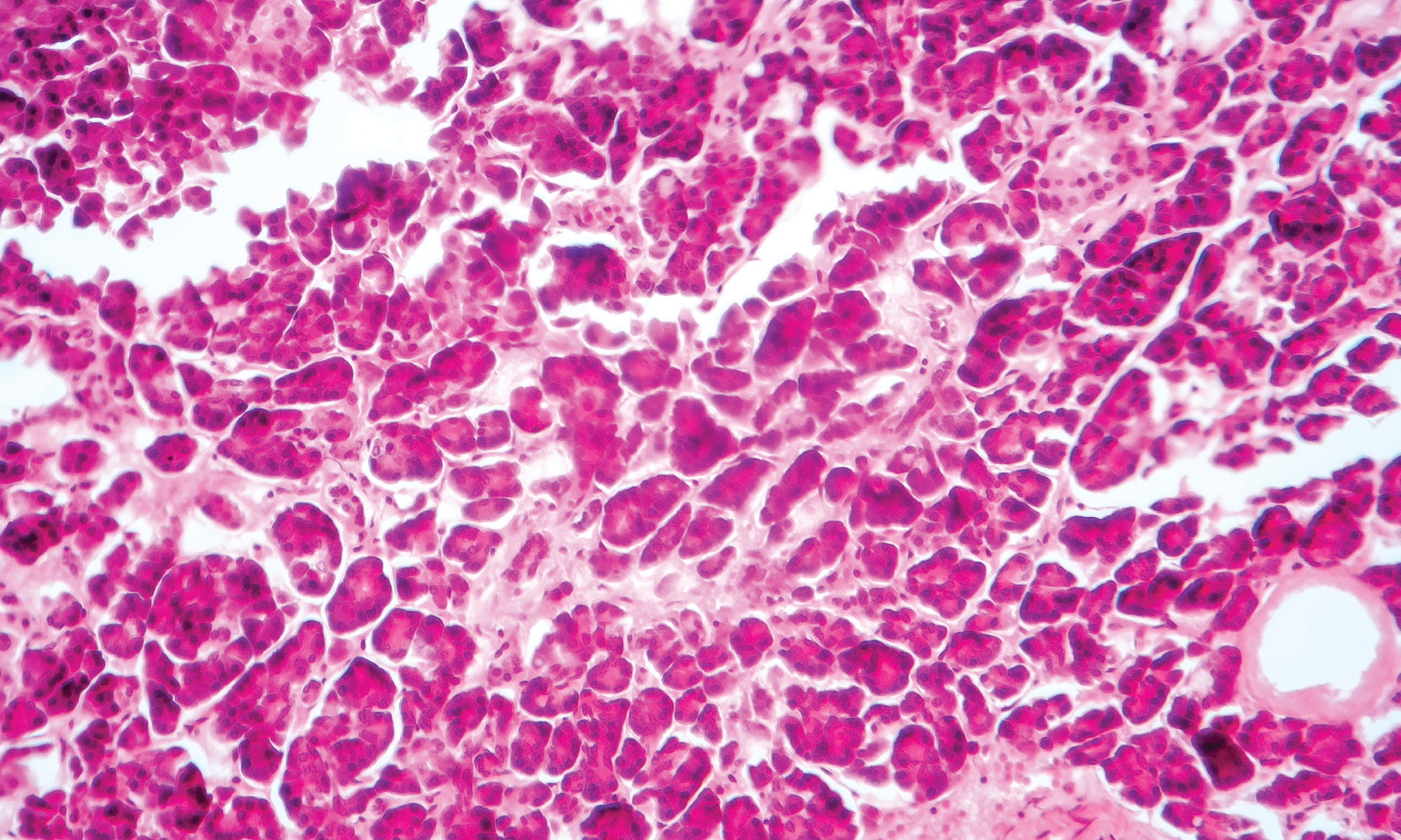 Image of Pancreatic Cells